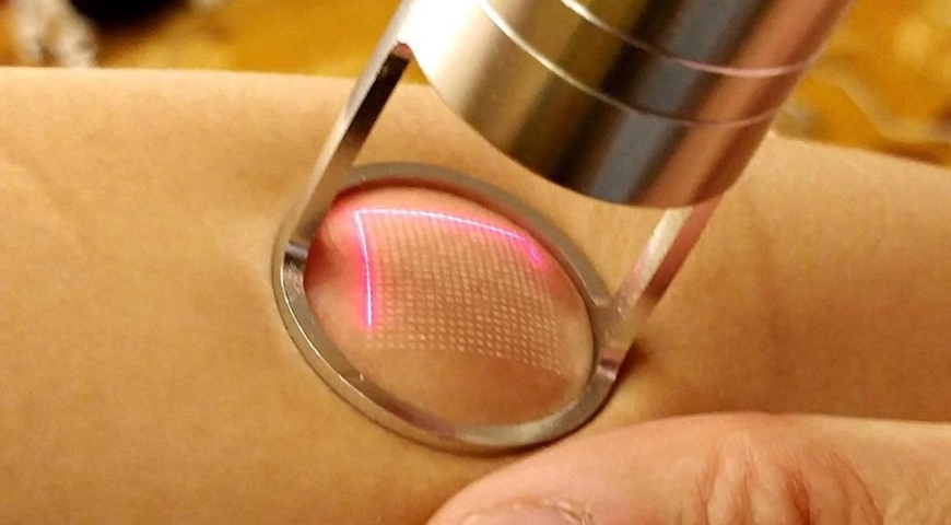 İzmir Fraksiyonel Lazer - Dermatolog Dr. Sedef Demirer, İzmir